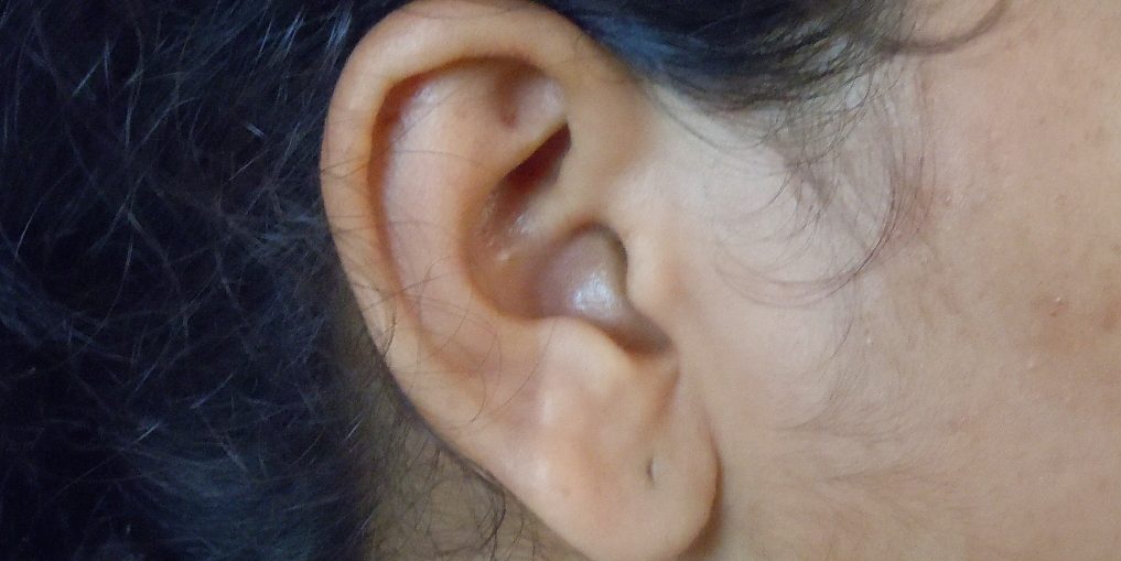 L'otite, un'infiammazione dell'orecchio che colpisce sia adulti che bambini